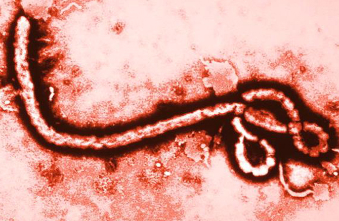 Ebola Virus